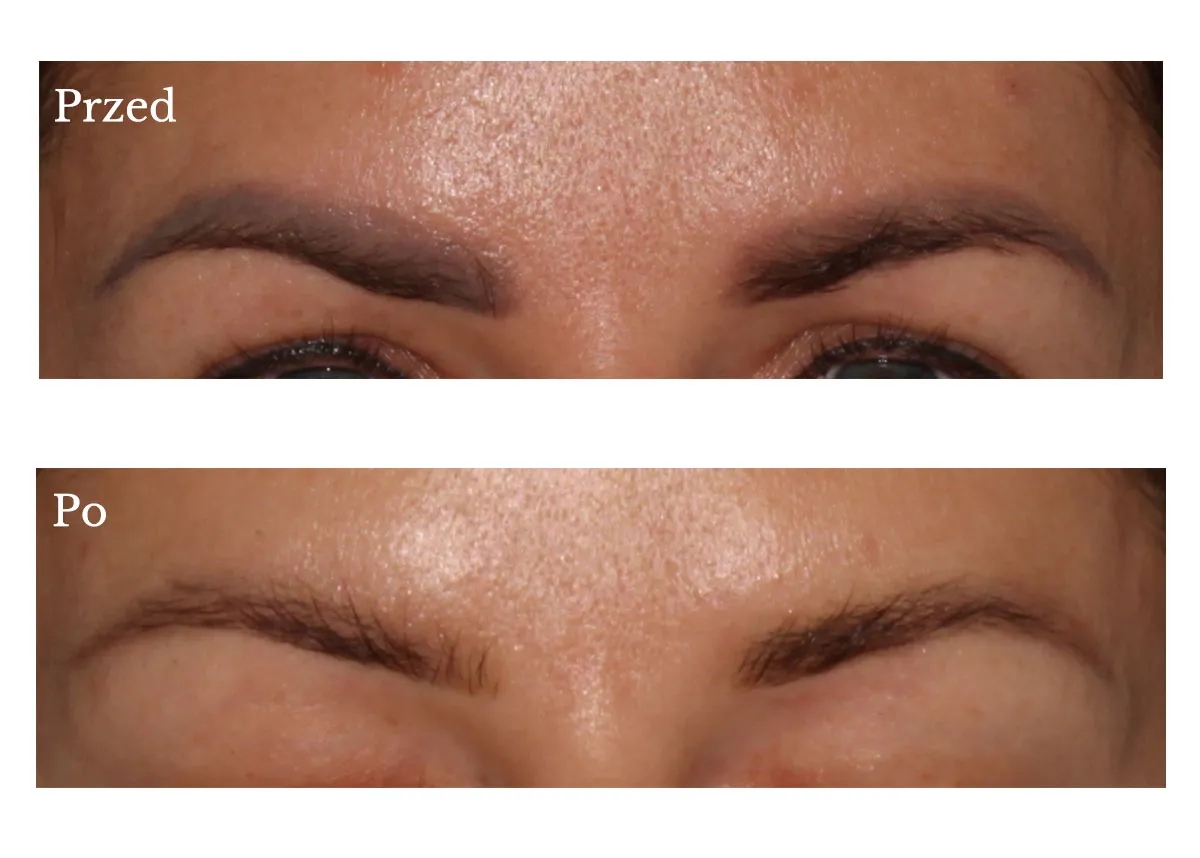 Jak usunąć makijaż permanentny brwi skutecznie i bezpiecznie?